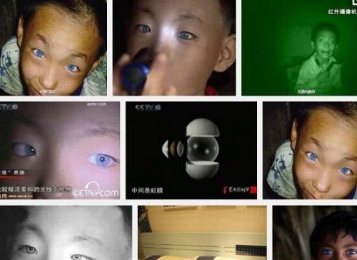 广西9岁猫眼男孩之谜 天生蓝瞳孔具有夜视眼视频/真相