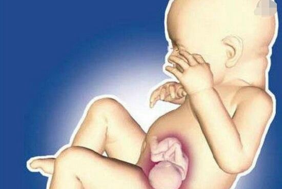 揭秘印度男子肚内36年的人形胎儿谜团 孪生兄弟胎内胎