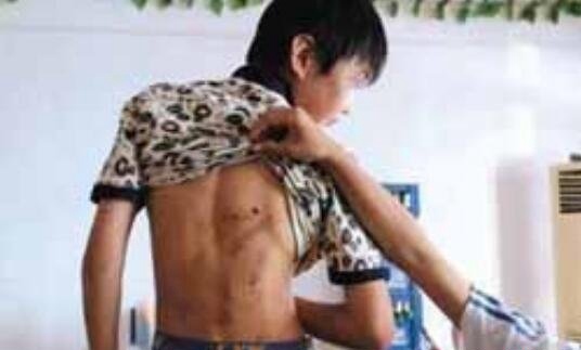 北京奶西村少年暴力事件视频 少年被打昏迷不醒面部被尿