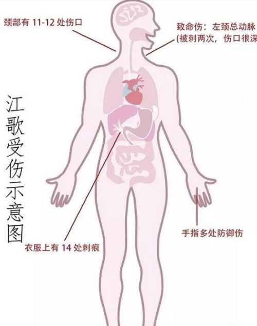 陈世峰下跪向江母磕头 检方称顶多被判20年不会是死刑