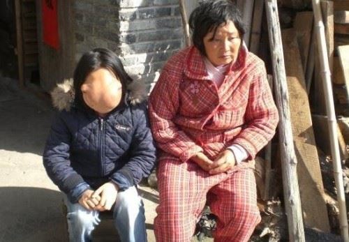 异脸河马女孩 病魔驱使下的少女太可怜了