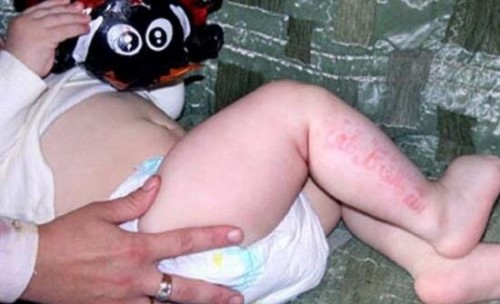 俄罗斯婴儿腿上皮肤能显示古兰经经文 胎记惊现经文/真主显灵