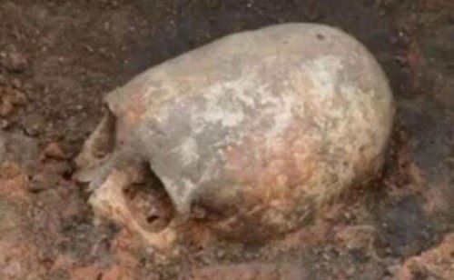 墨西哥怪异头骨之谜 人类和外星人的另类混血儿科学证实