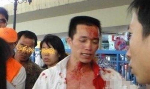 广西柳州飙血哥事件 头破血流还手持木棍要血拼到底