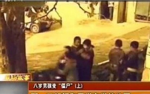科学揭秘重庆开县的僵尸男孩 手足僵硬吸食人血患癔症