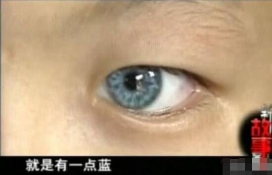 广西9岁猫眼男孩之谜 天生蓝瞳孔具有夜视眼视频/真相