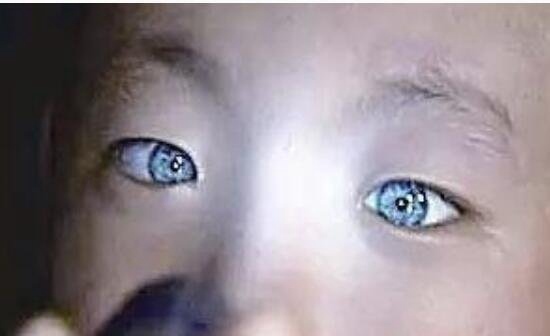 广西9岁猫眼男孩之谜 天生蓝瞳孔具有夜视眼视频/真相