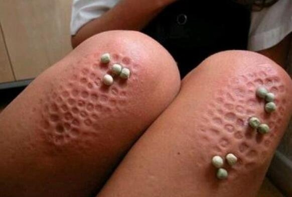 莲蓬乳和空手指是真的吗？空手指莲蓬乳恶心图片大全