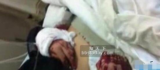 长春砍手门真相 死者吴天昊被砍断双手身亡曾是恶霸