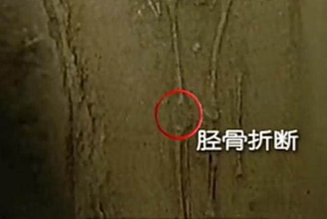七千年前的“零口姑娘”究竟是怎么死的? 七千年前的“零口姑娘”究竟是怎么死的?