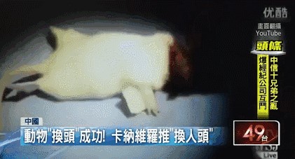 世界首例换头手术成功了吗 在中国取得成功(耗时18小时花费7千万)