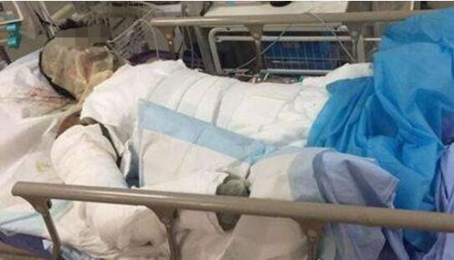 偷钓鱼触碰高压线被电 鱼竿导电性强触碰后会被"电击"