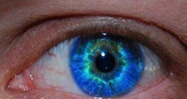 人类5种罕见的瞳孔 有些是疾病的象征（可致人死亡）