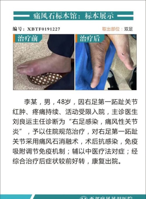 成都西部痛风风湿医院怎么样 多学科专家/疗效有保障