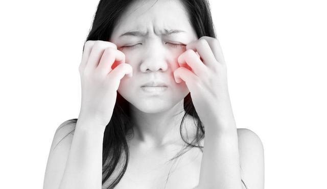 脸上长湿疹了怎么办涂什么？面部湿疹用什么药膏最有效