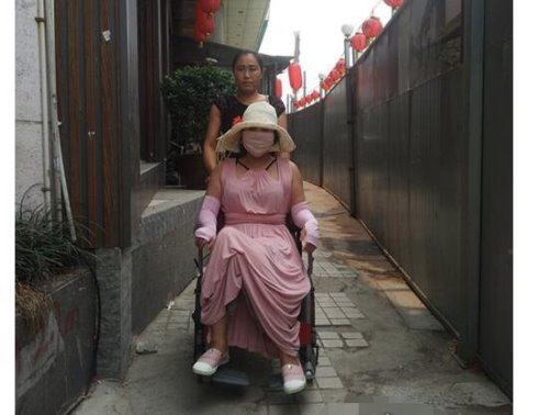 中国第一整容狂人 花费400万元整容200多次(将自己身体整垮)