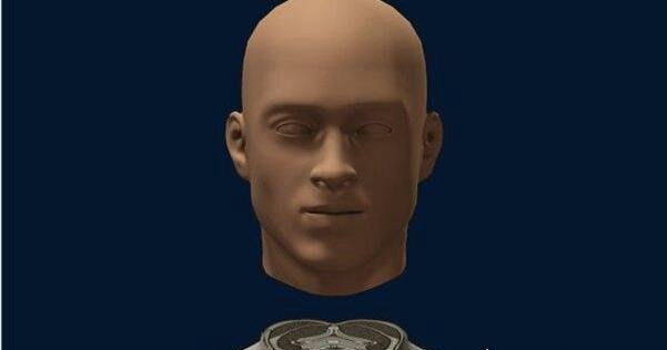 世界首例换头手术成功了吗 在中国取得成功(耗时18小时花费7千万)