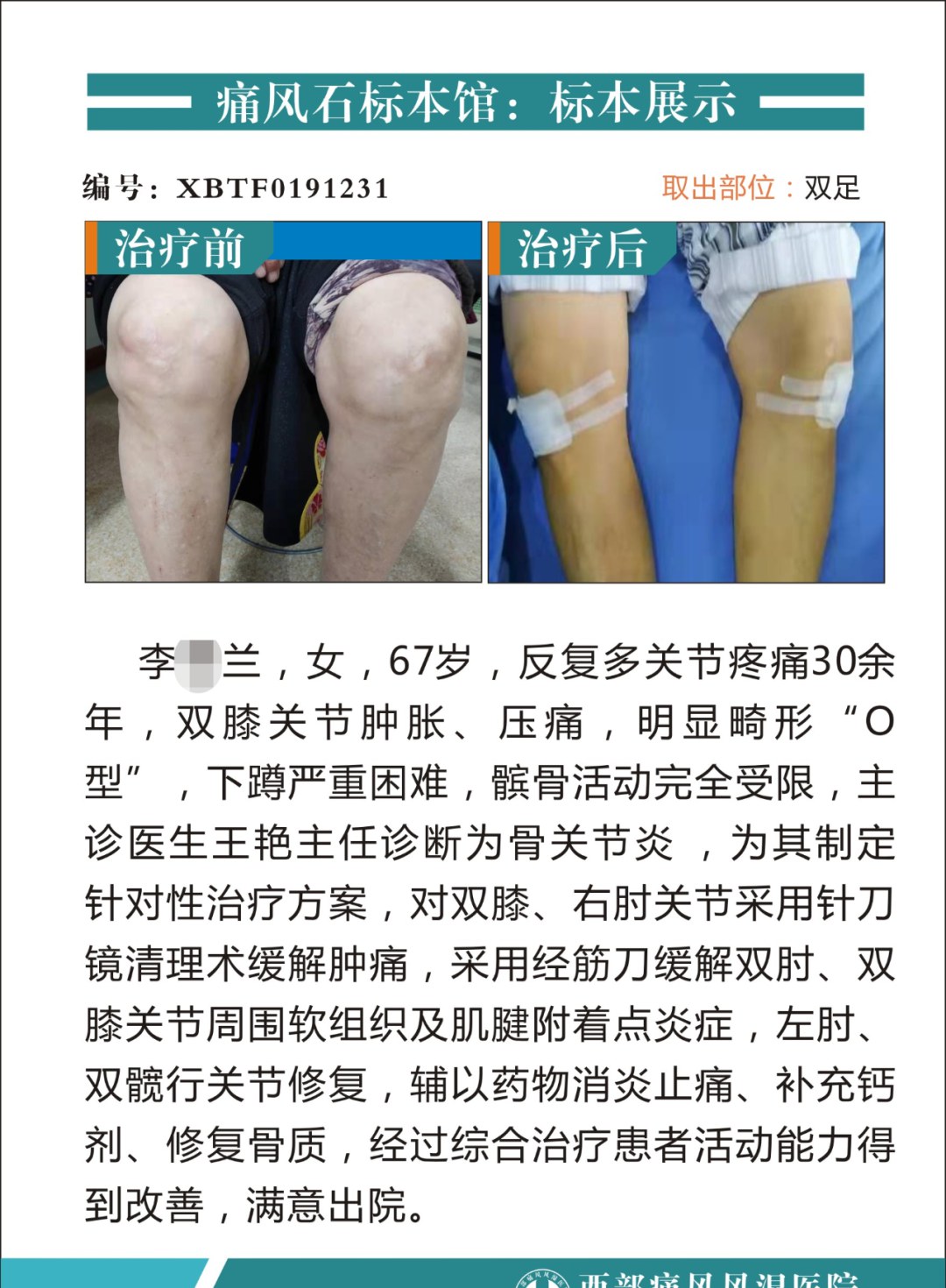 成都西部痛风风湿医院怎么样 多学科专家/疗效有保障