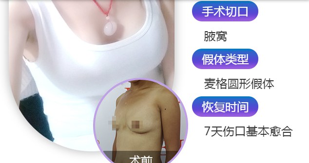 南京美贝尔整形医院费用平价吗 手术为艺术