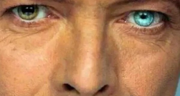 世界上最美的9双眼睛 令人一见倾心（瞳孔颜色罕见美丽）
