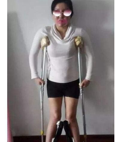 中国第一整容狂人 花费400万元整容200多次(将自己身体整垮)