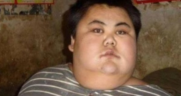 第一名重达1500斤 世界十大最胖的人(肥胖会危及生命)
