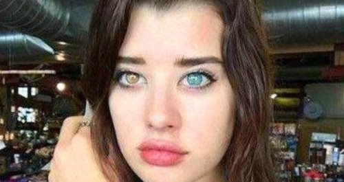 人类5种罕见的瞳孔 有些是疾病的象征（可致人死亡）