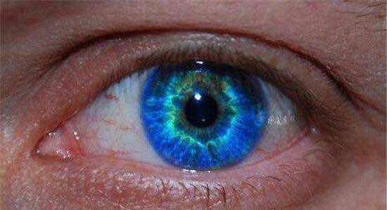人类5种罕见的瞳孔 原来这个世界真的有白眼(视网膜癌)