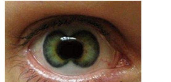 世界上最恐怖的眼睛 双瞳孔人在古代是吉利和帝王的象征