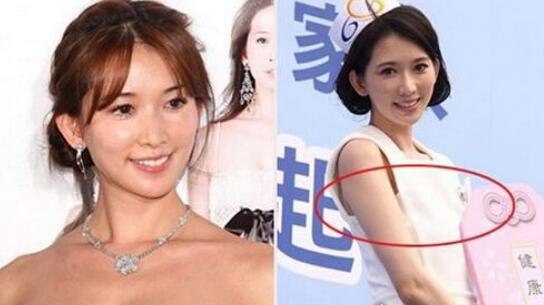 林志玲的胸被马踩爆变平胸 隆假胸惨遭言承旭抛弃