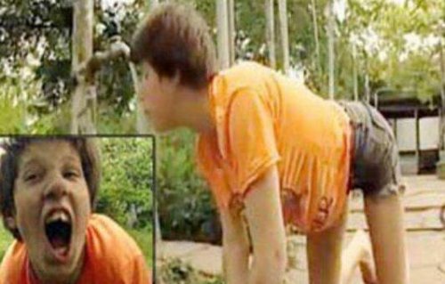 34岁狗孩奥克纳·马拉娅现状 狗性难移男友被吓跑