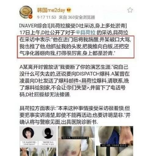 具荷拉男友家暴事件大反转 被打子宫出血还受到性爱视频威胁