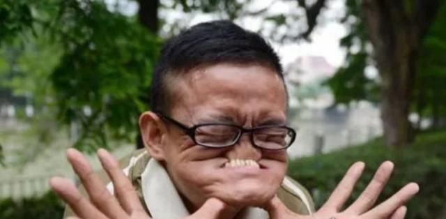 世界上最丑的人 打破吉尼斯最丑世界纪录(无人敢与他比丑)