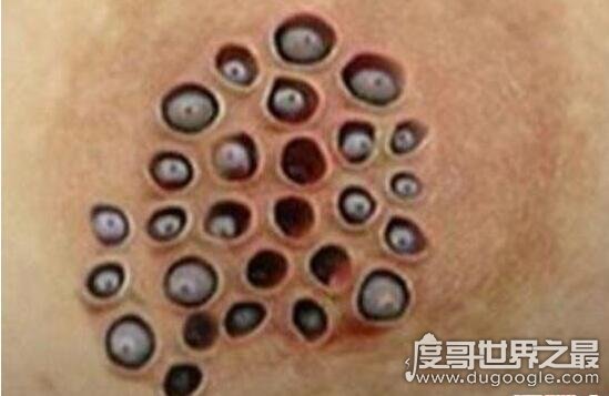 真实的莲蓬乳图片大全 空手指莲蓬乳看完必炸毛(慎入)
