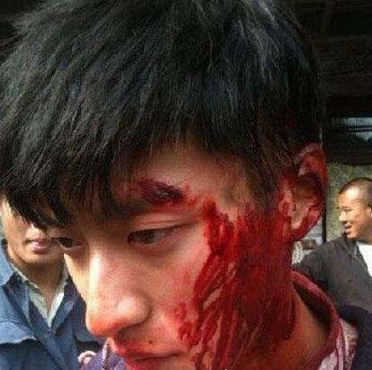 kimi乔任梁怎么死的真相 长期遭受抑郁症折磨自杀