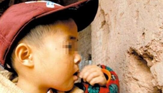 世界十大奇葩异食癖患者 现实版吃土少女喝汽油