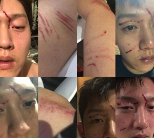 具荷拉男友家暴事件大反转 被打子宫出血还受到性爱视频威胁