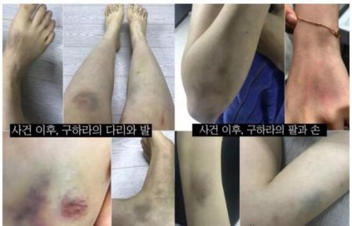 具荷拉男友家暴事件大反转 被打子宫出血还受到性爱视频威胁
