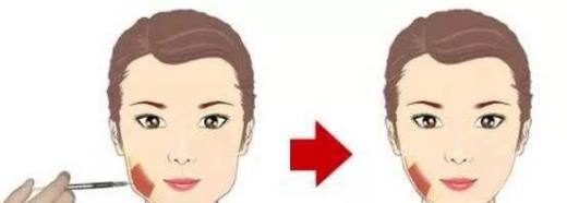 瘦脸针多少钱一针 瘦脸针能保持多久