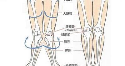 x型腿怎么矫正?