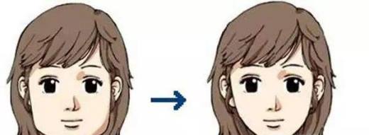 瘦脸针多少钱一针 瘦脸针能保持多久