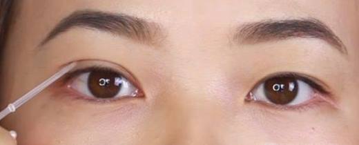 不用做手术 把单眼皮变双眼皮的实用好方法