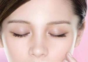 痘痘里面挤出来的白色东西是皮脂还是螨虫?
