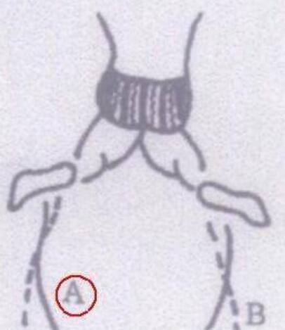 蛙泳腿部动作图解