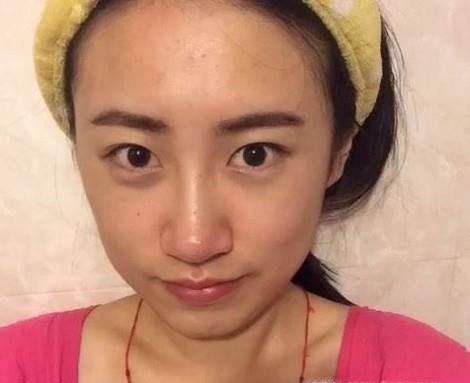 用什么可以收缩毛孔 不看会后悔的缩小毛孔妙方